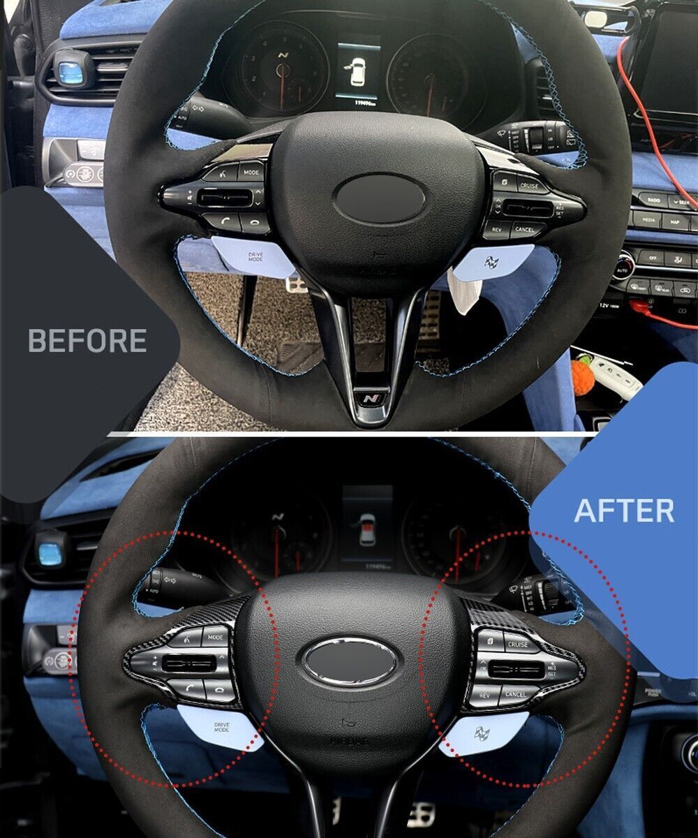 Carbon Fiber Steering Wheel Bezel Cover Frame for Hyundai I30 N, Kona N, I20 N